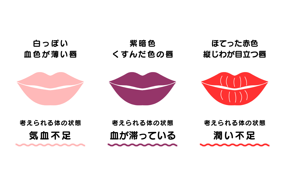 唇の色と体質の図